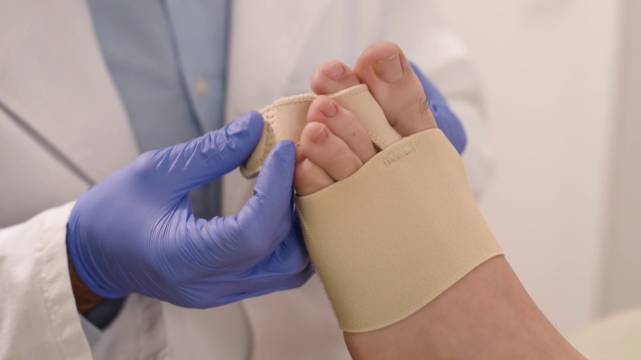 Strapping For Plantar Plate Tear Podiatry Tube